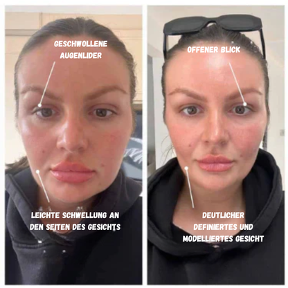 Solazis®-Lymphatic brush